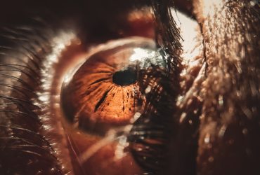 Are Sanpaku Eyes Rare