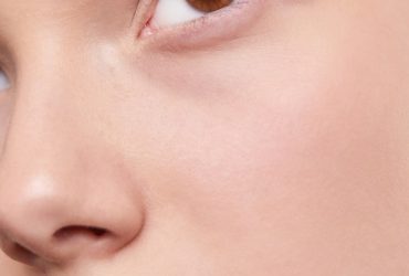 How Rare Are Sanpaku eyes