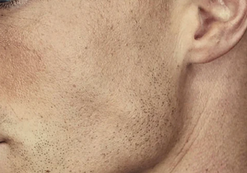 jawline exercise tool