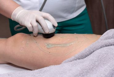 acoustic wave therapy