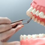 dental implants service