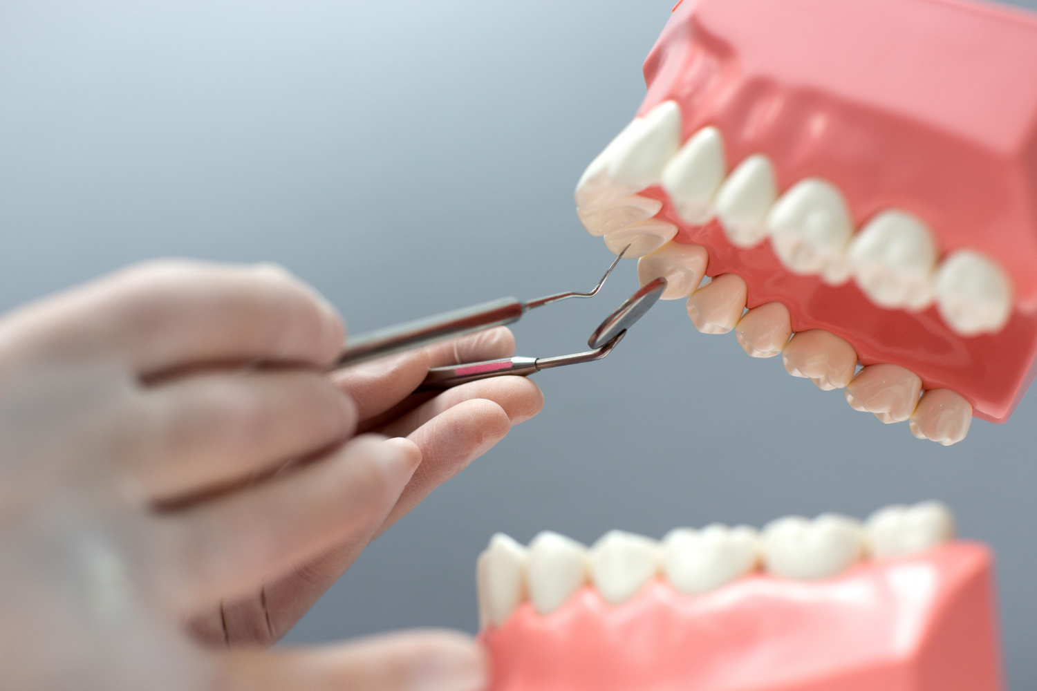 dental implants service